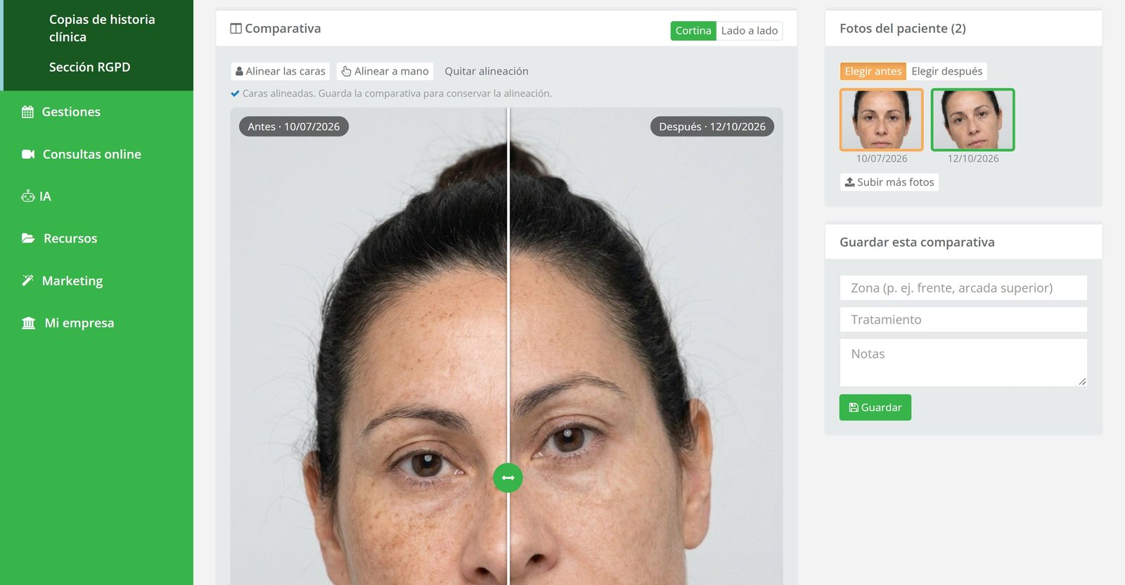 Antes y después alineado