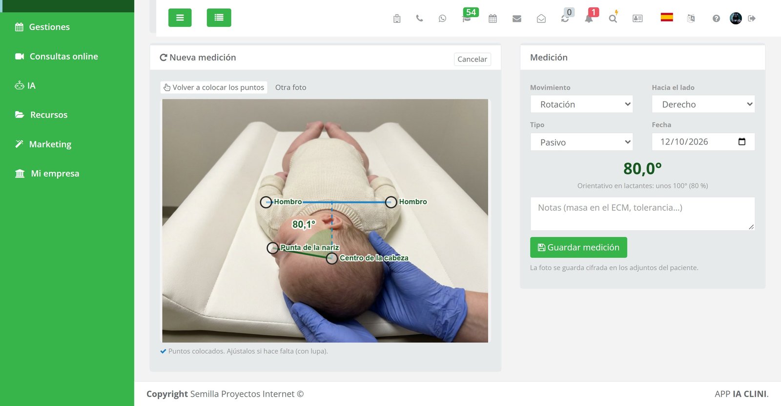 Rotación cervical del bebé